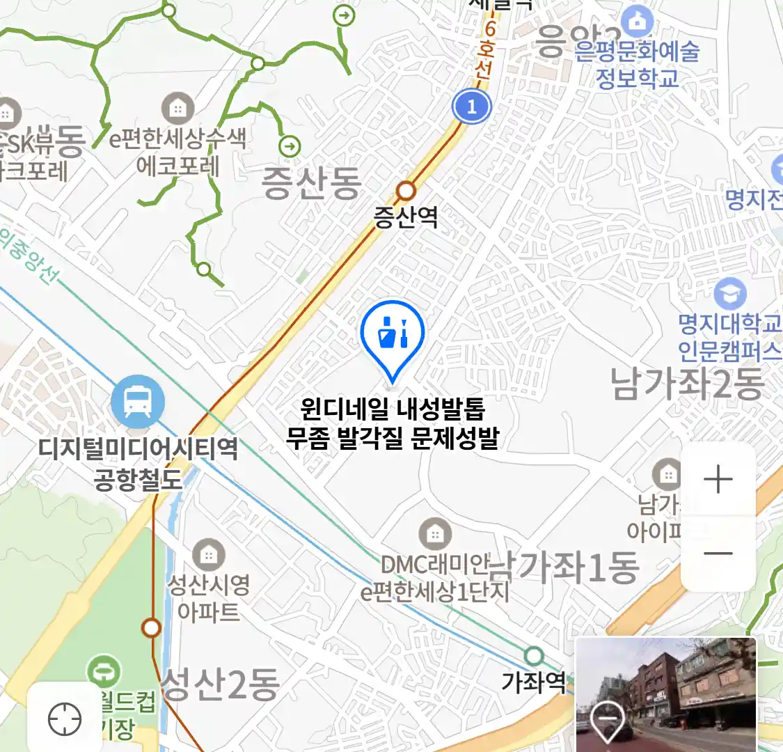 윈디네일 내성발톱 무좀 발각질 문제성발 위치