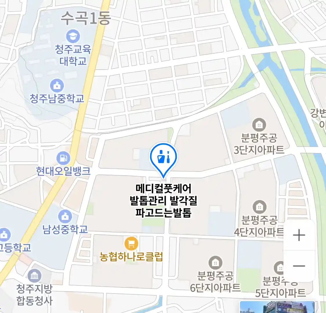 메디컬풋케어 발톱관리 발각질 파고드는발톱 위치