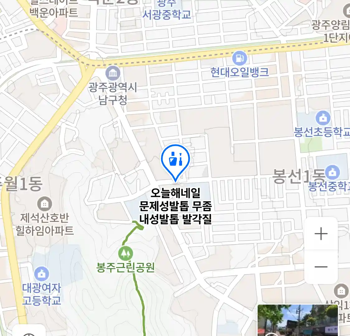 오늘해네일 문제성발톱 무좀 내성발톱 발각질 위치