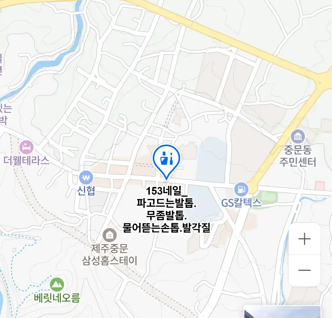 153네일_파고드는발톱.무좀발톱.물어뜯는손톱.발각질 위치