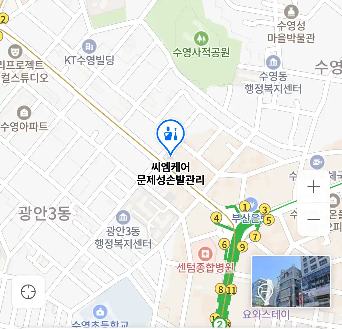 씨엠케어 문제성손발관리 위치